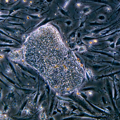 Acreditados 45 estudios internacionales para aplicaciones clínicas de células madre de cordón umbilical